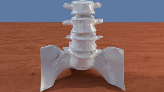 Spine picture