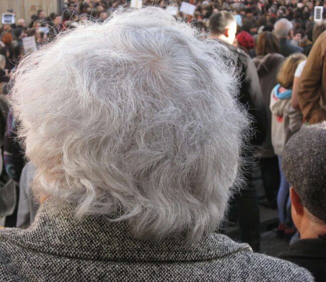 white-hair-597466_1280 Thinning aging hair